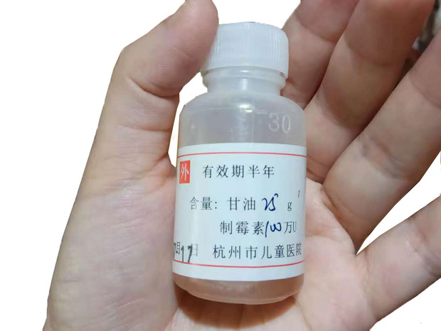 寶寶嘴里長了白色斑點，很可能是鵝口瘡